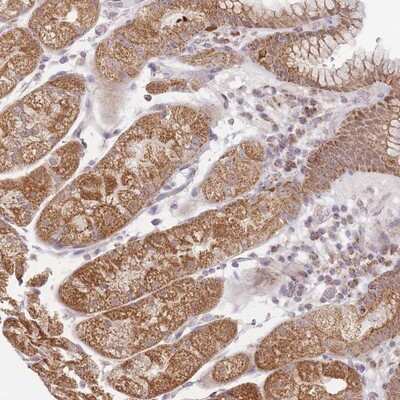 Immunohistochemistry-Paraffin: ESRP2 Antibody [NBP2-13972]