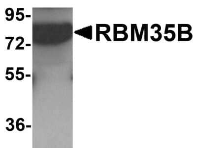 Western Blot: ESRP2 AntibodyBSA Free [NBP1-76537]