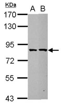 Western Blot: ESRP2 Antibody [NBP2-16375]