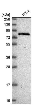 Western Blot: ESRP2 Antibody [NBP2-58259]