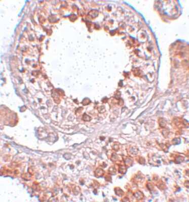 Immunohistochemistry-Paraffin: ESX1 Antibody - BSA Free [NBP1-77114]
