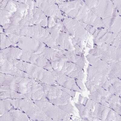 Immunohistochemistry-Paraffin: ESX1 Antibody [NBP2-13973]