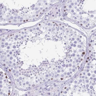 Immunohistochemistry-Paraffin: ESX1 Antibody [NBP2-13973]