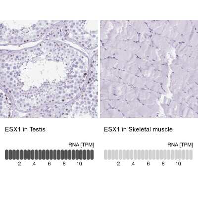 Immunohistochemistry-Paraffin: ESX1 Antibody [NBP2-13973]