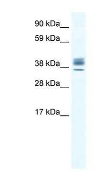 Western Blot: ESX1 Antibody [NBP1-80214]