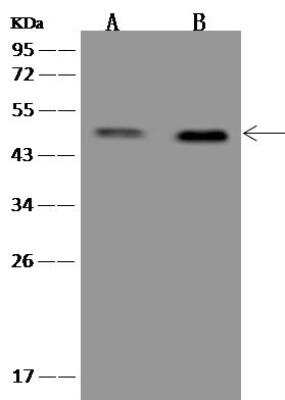 Western Blot: ESX1 Antibody [NBP3-12666]