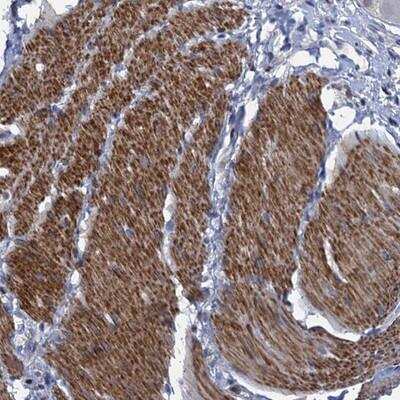 Immunohistochemistry: ESYT3 Antibody [NBP1-94101]