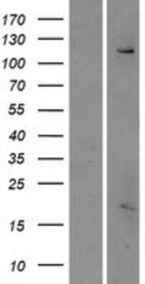 Western Blot: ESYT3 Overexpression Lysate [NBP2-06103]