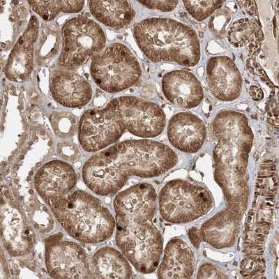 Immunohistochemistry-Paraffin: ETAA1 Antibody [NBP1-90473]