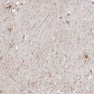 Immunohistochemistry-Paraffin: ETAA1 Antibody [NBP2-38229]