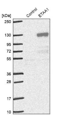 Western Blot: ETAA1 Antibody [NBP1-90473]