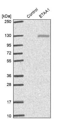 Western Blot: ETAA1 Antibody [NBP2-38229]