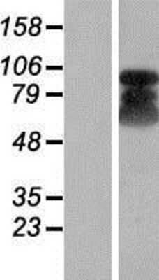 Western Blot: ETAA1 Overexpression Lysate [NBP2-06747]