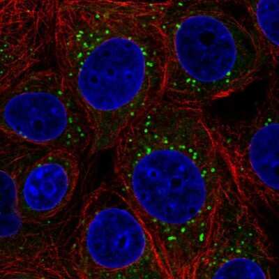 Immunocytochemistry/ Immunofluorescence: ETEA Antibody [NBP2-57046]