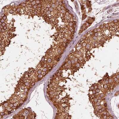 Immunohistochemistry: ETEA Antibody [NBP2-68916]