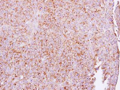 Immunohistochemistry-Paraffin: ETEA Antibody [NBP2-16381]