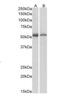 Western Blot: ETEA Antibody [NB100-1296]