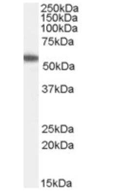 Western Blot: ETEA Antibody [NB100-1296]