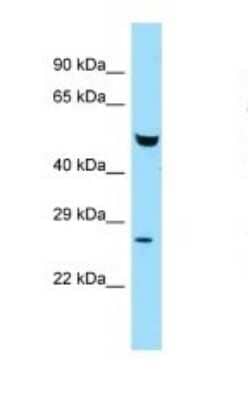 Western Blot: ETEA Antibody [NBP1-98272]