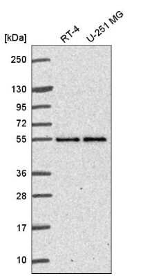 Western Blot: ETEA Antibody [NBP2-57425]