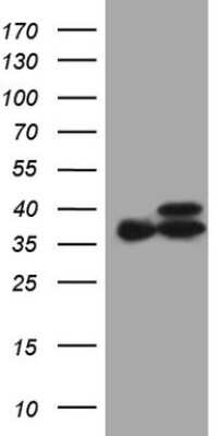 Western Blot: ETFA Antibody (OTI5C4) [NBP2-45542]