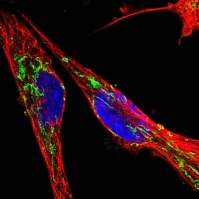 Immunocytochemistry/ Immunofluorescence: ETFA Antibody [NBP1-84856]