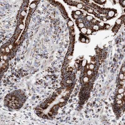 Immunohistochemistry-Paraffin: ETFA Antibody [NBP1-84854]