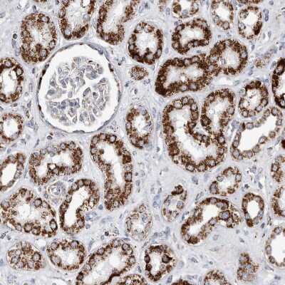 Immunohistochemistry-Paraffin: ETFA Antibody [NBP1-84854]