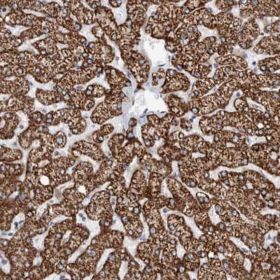 Immunohistochemistry-Paraffin: ETFA Antibody [NBP1-84854]