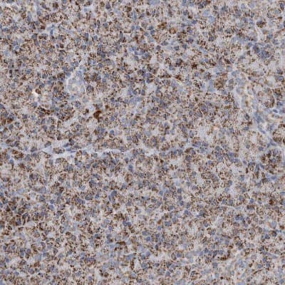 Immunohistochemistry-Paraffin: ETFA Antibody [NBP1-84854]