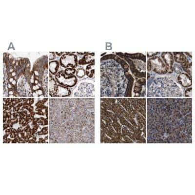 Immunohistochemistry-Paraffin: ETFA Antibody [NBP1-84854]