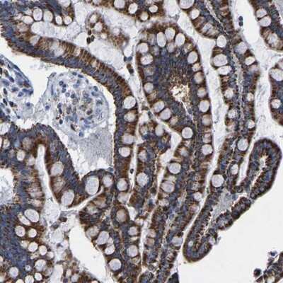 Immunohistochemistry-Paraffin: ETFA Antibody [NBP1-84855]