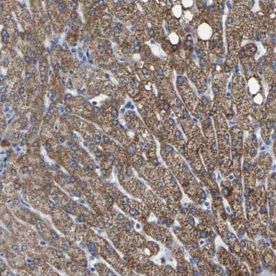 Immunohistochemistry-Paraffin: ETFA Antibody [NBP1-84855]