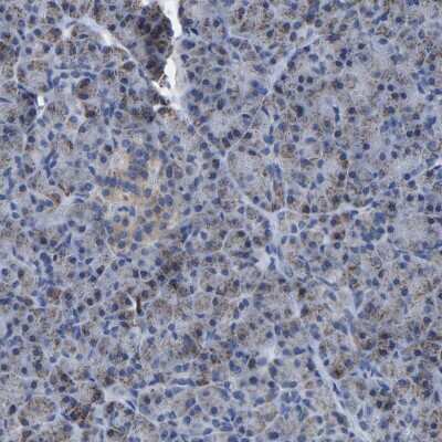 Immunohistochemistry-Paraffin: ETFA Antibody [NBP1-84855]