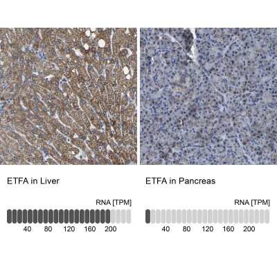 Immunohistochemistry-Paraffin: ETFA Antibody [NBP1-84855]
