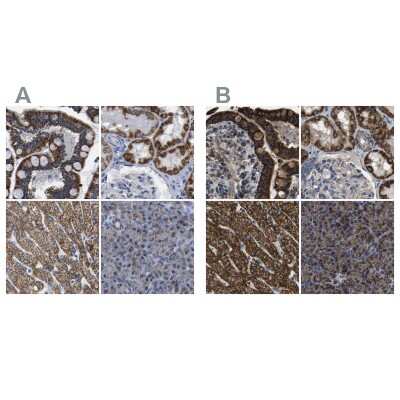 Immunohistochemistry-Paraffin: ETFA Antibody [NBP1-84855]