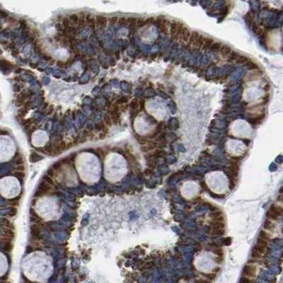 Immunohistochemistry-Paraffin: ETFA Antibody [NBP1-84855]