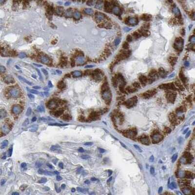 Immunohistochemistry-Paraffin: ETFA Antibody [NBP1-84855]