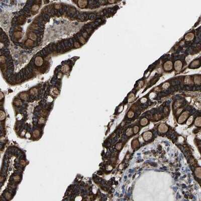 Immunohistochemistry-Paraffin: ETFA Antibody [NBP1-84856]