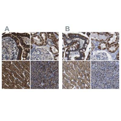 Immunohistochemistry-Paraffin: ETFA Antibody [NBP1-84856]