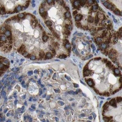 Immunohistochemistry-Paraffin: ETFA Antibody [NBP1-84856]