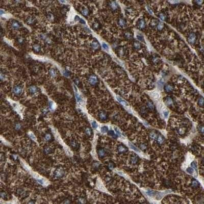 Immunohistochemistry-Paraffin: ETFA Antibody [NBP1-84856]