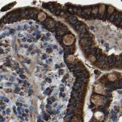 Immunohistochemistry-Paraffin: ETFA Antibody [NBP1-84856]