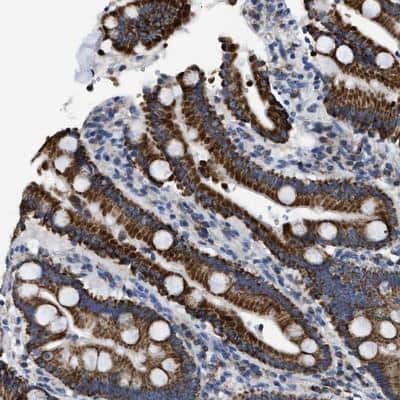 Immunohistochemistry-Paraffin: ETFA Antibody [NBP1-84857]