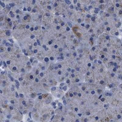 Immunohistochemistry-Paraffin: ETFA Antibody [NBP1-84857]