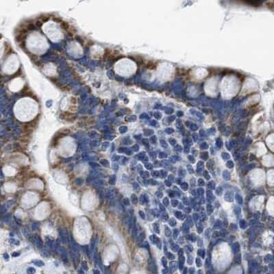 Immunohistochemistry-Paraffin: ETFA Antibody [NBP1-84857]