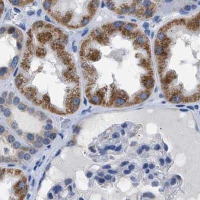 Immunohistochemistry-Paraffin: ETFA Antibody [NBP1-84857]
