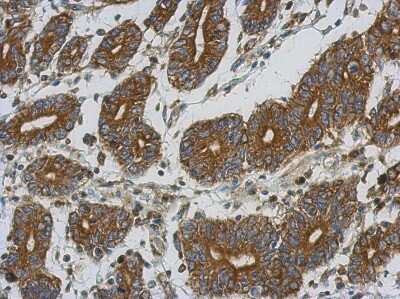 Immunohistochemistry-Paraffin: ETFA Antibody [NBP2-16382]