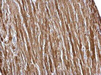 Immunohistochemistry-Paraffin: ETFA Antibody [NBP2-16382]