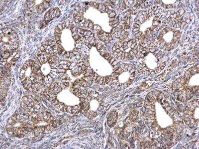 Immunohistochemistry-Paraffin: ETFA Antibody [NBP2-16383]